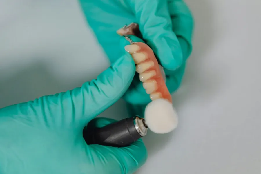 bone grafting dental implants