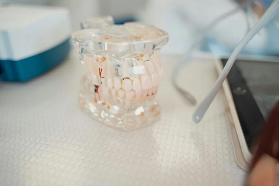dental implants for missing teeth