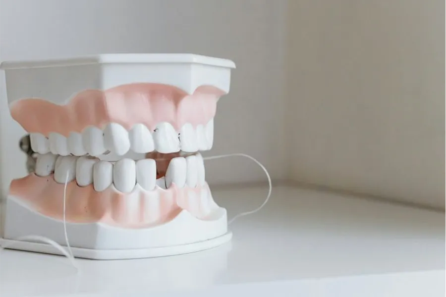 misaligned teeth