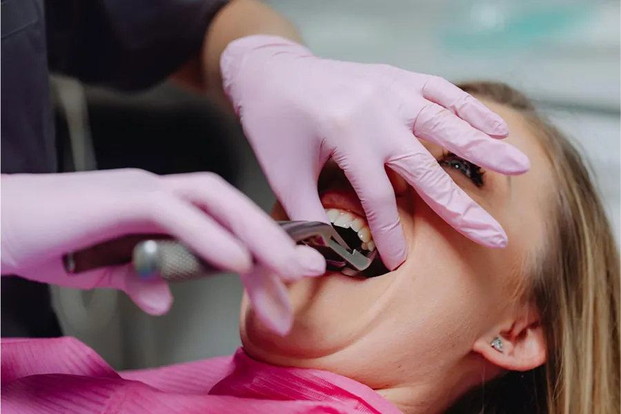 signs tooth extraction