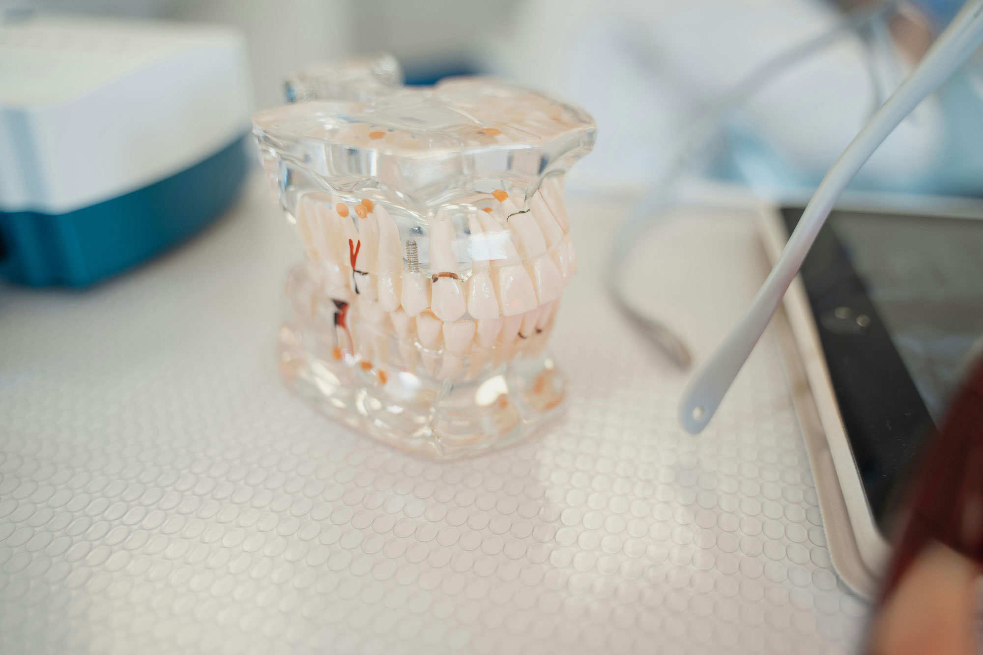 Dental Implants: A Life-Changing Solution for Missing Teeth