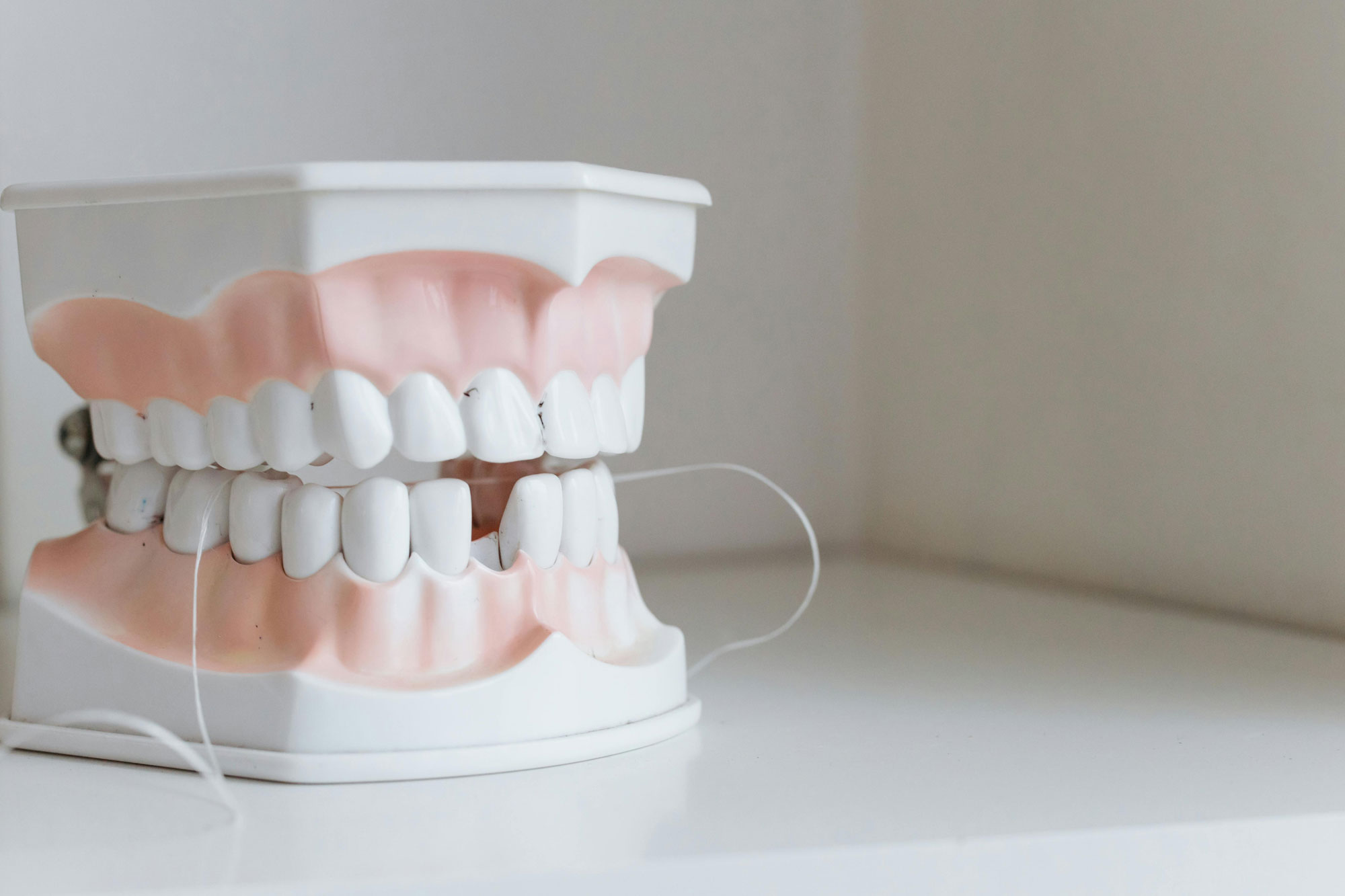 The Impact of Misaligned Teeth on Oral Health