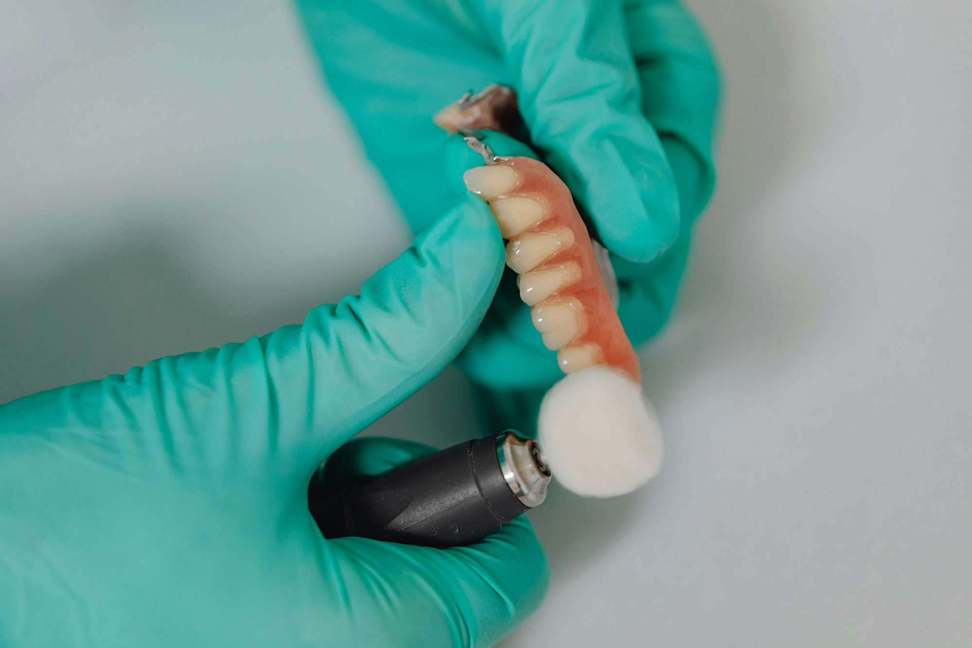 The Role of Bone Grafting in Dental Implants