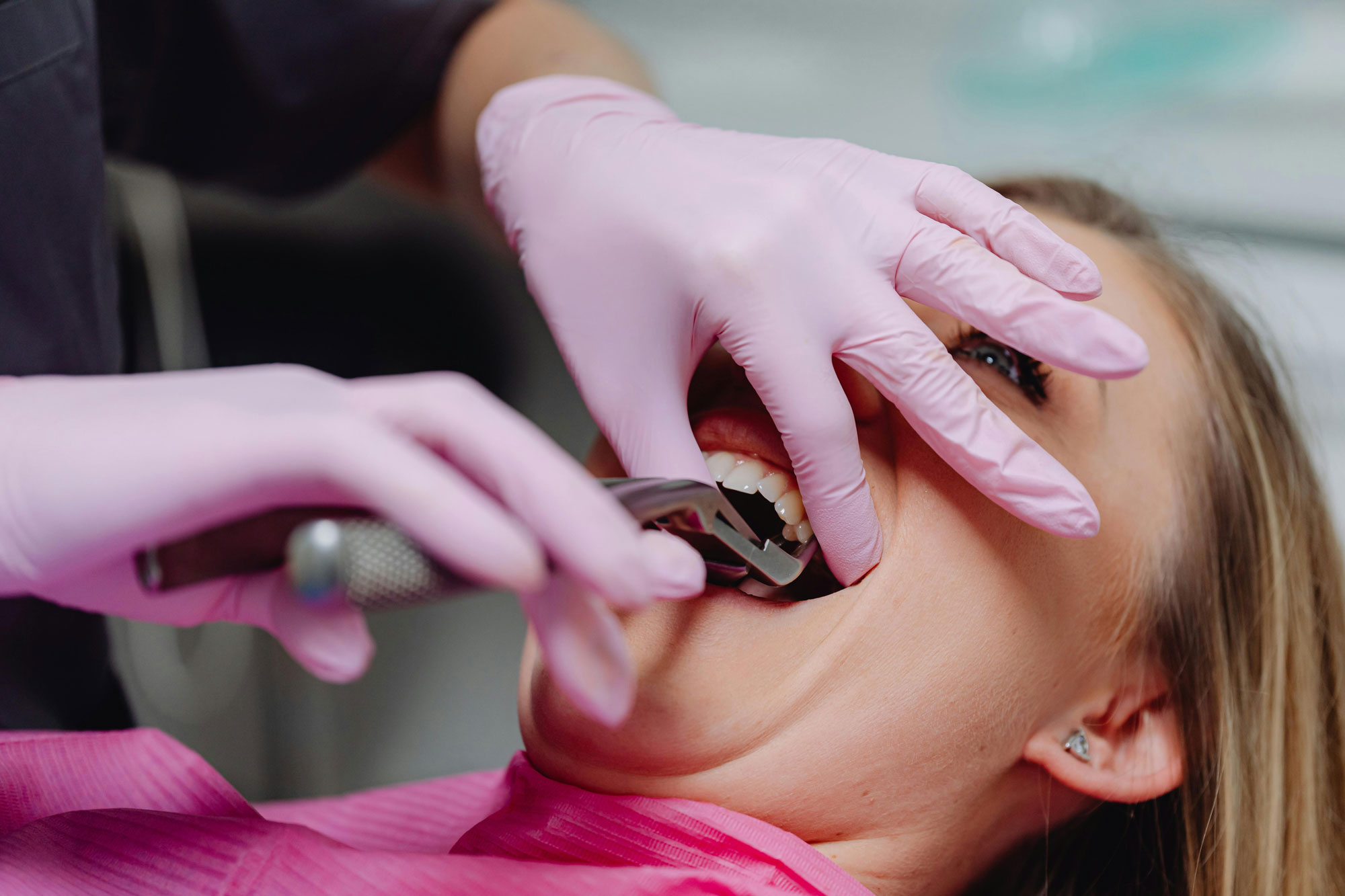 The Top Signs You Need a Tooth Extraction From Your Dentist in Macedonia, OH