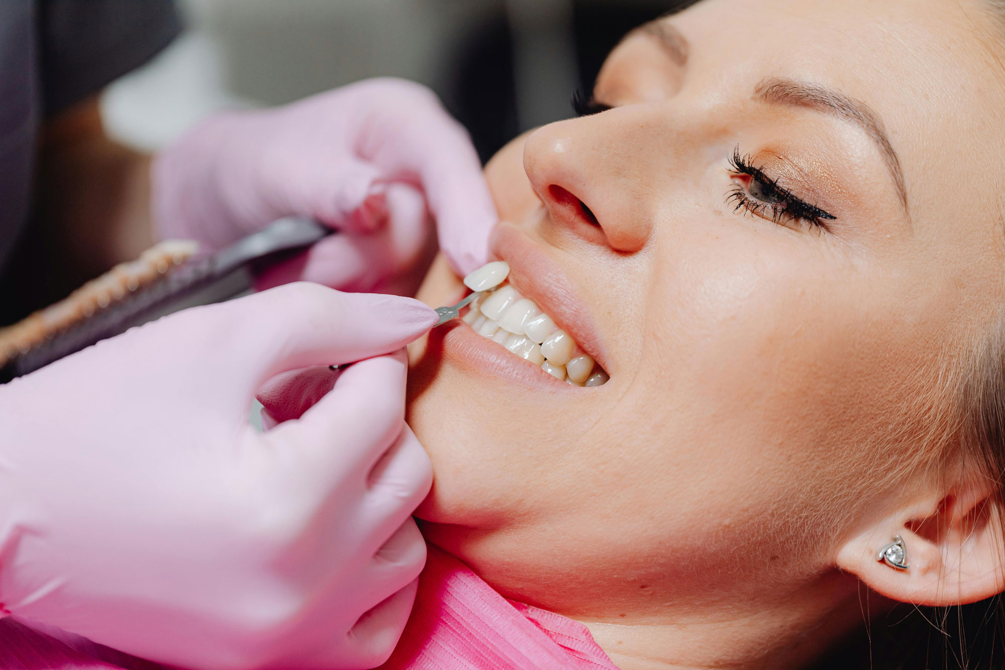Top 5 Signs You Might Need Oral Surgery