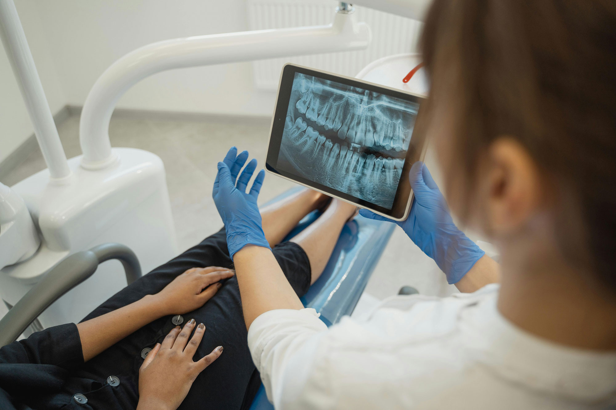 What is Full-Mouth Rehabilitation