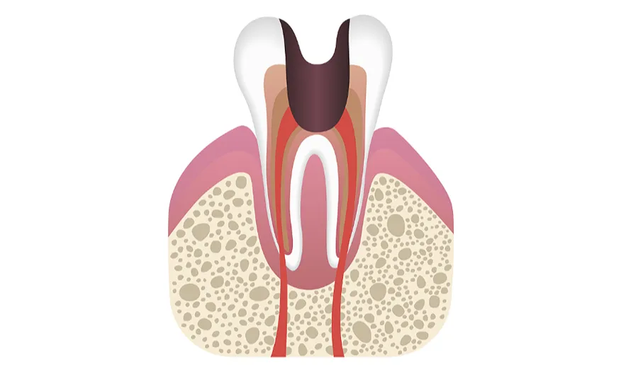 periodontics