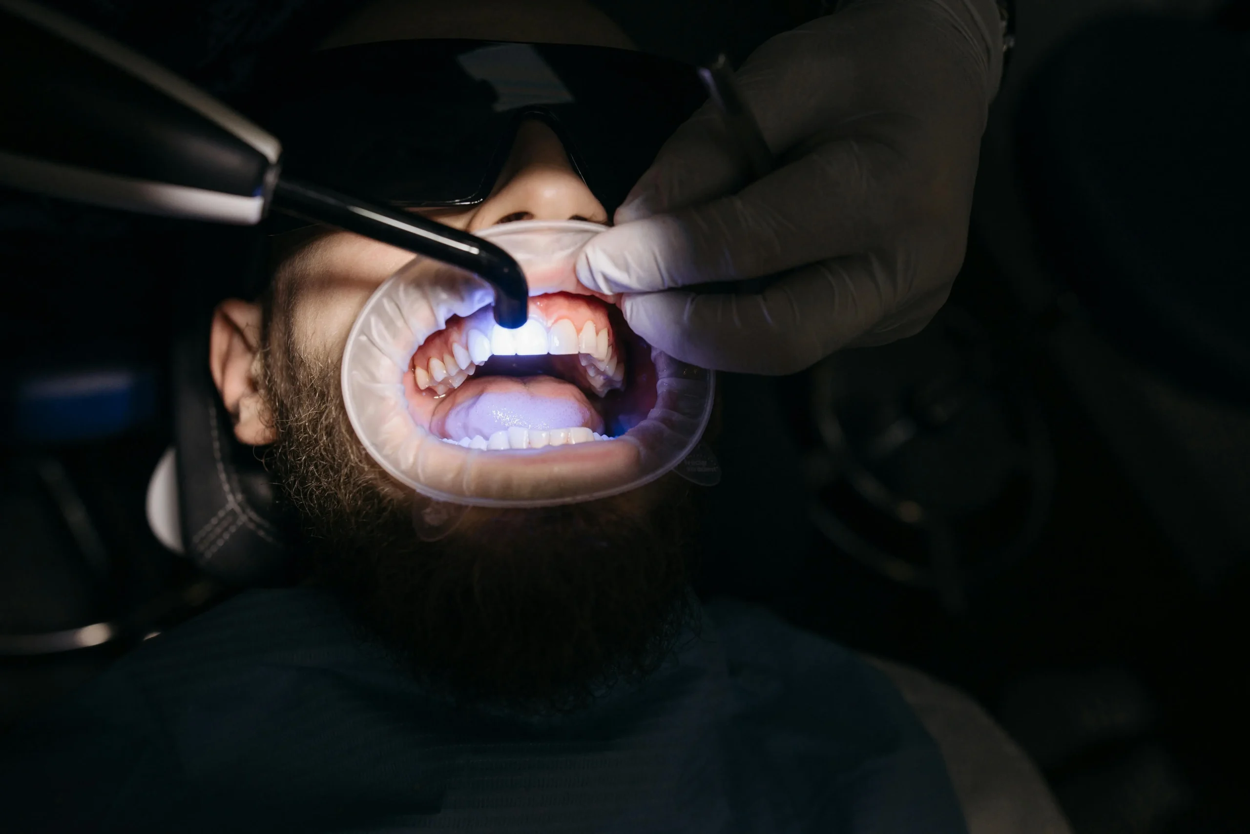 dentist using curing light during a composite dental filling procedure on a patient