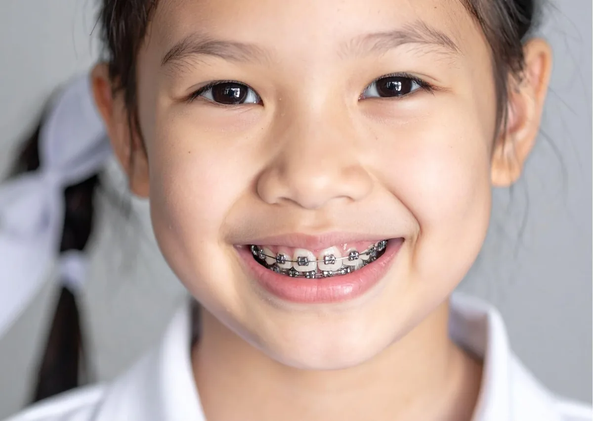 Child smiling with metal braces during orthodontic treatment.