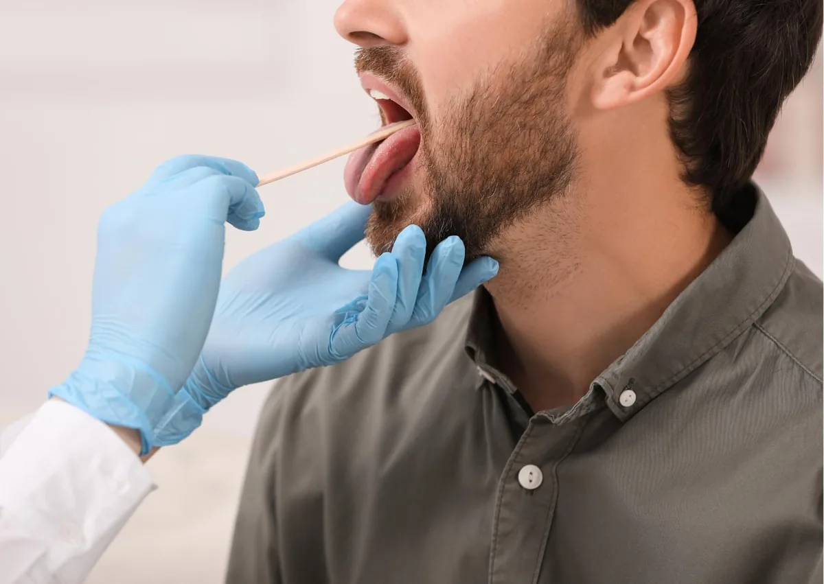 Healthcare professional examining a patient’s tongue and mouth for signs of oral thrush.