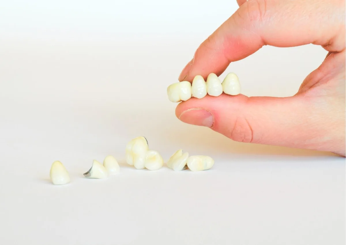 Different types of dental crowns held in hand for comparison of tooth restoration options.