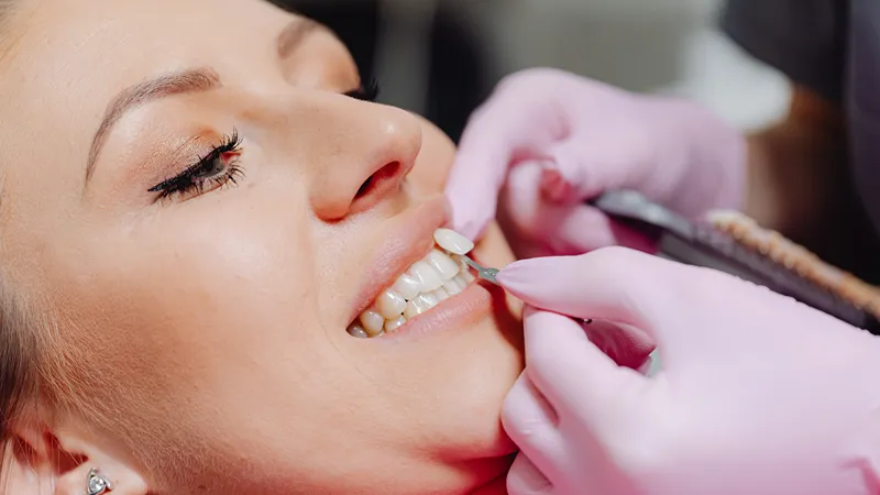a woman during veneer fitting